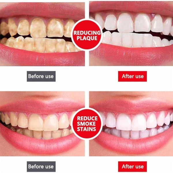Ayashi SP-4 Ultra Whitening Toothpaste | Protects Gums & Freshens Breath Paste | Stain Remover for Brighter Smile (100 ML) - Image 4