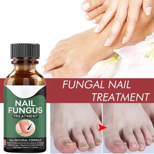 fast-nail-fungal-treatments-nail-repair-essences-serum-care-treatments-foot-nail-fungus-removal-gel-4 – 5