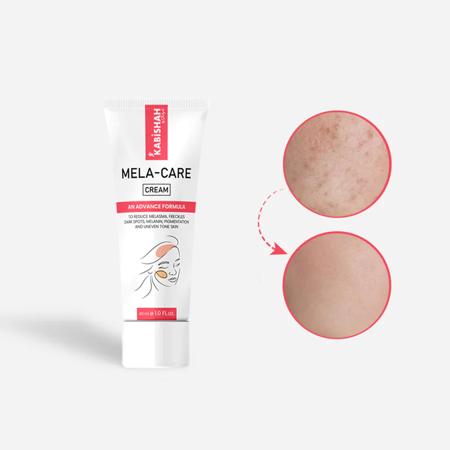 Pack of 2 – Face Wash & Mela Care Cream Pigmentation Bundle | Skin Brightening & Dark Spot Removal Formula (Face Wash 120ml + Cream 50ml) - Image 2