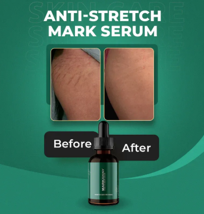 Markaway Stretch Mark Serum 30ml – Herbal Stretch Mark Removal, Skin Hydration, Firming & Dark Spot Correction - Image 2