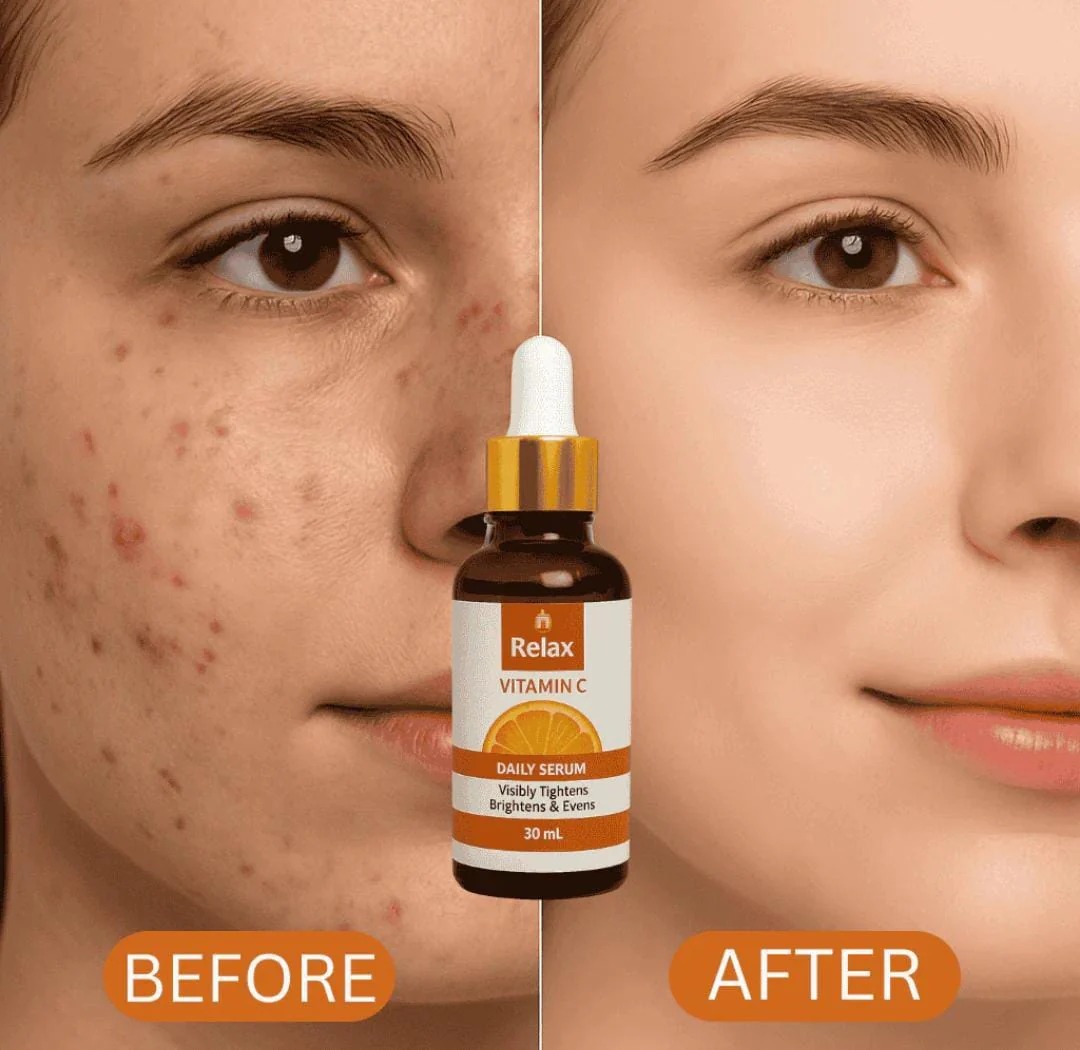 Relax Vitamin C Daily Face Serum 30ml – Brightening, Anti-Aging, Hydrating Serum for Glowing & Radiant Skin