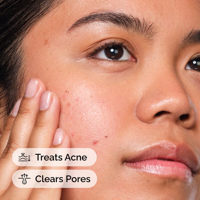 The Ordinary Salicylic Acid 2% Solution, a water-based serum designed for blemish-prone and oily skin.30ML-Imported Quality - Image 2