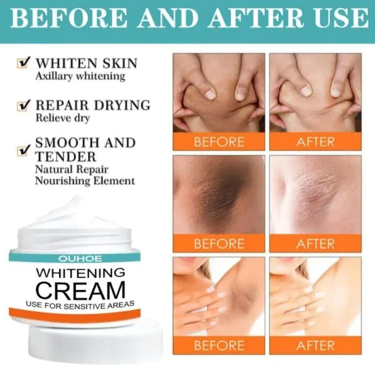 Pack of 2 Sensitive Area Whitening Cream – Dark Spot Lightening for Underarms, Inner Thighs & Private Parts (30ml Each) - Image 3