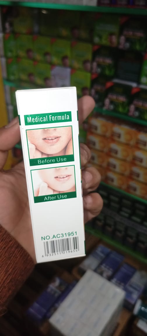 Anti-Freckle Whitening Facial Serum 30ml Brightening Formula for Clear, Even-Toned Skin - Image 3