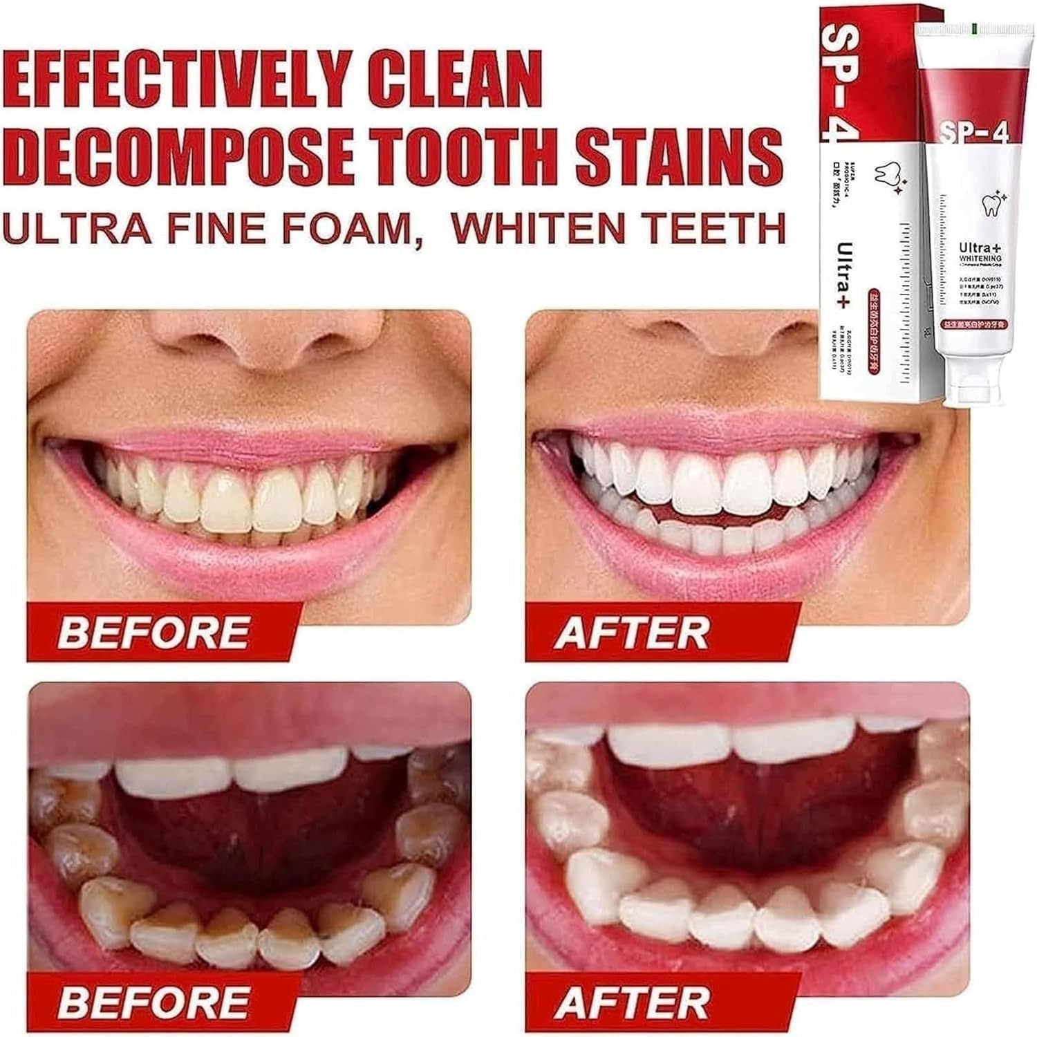 Yayashi Sp-4 Ultra Whitening Toothpaste Probiotic Stain Remover Stain Removing Toothpaste, Protects Gums Freshens Breath, for Everyone - Image 2