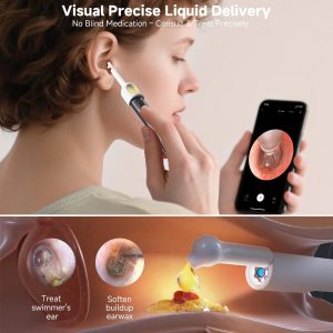 Rechargeable Smart Wireless Ear Camera Kit | Visual Ear Wax Removal Tool With Mobile Display | Random Colour