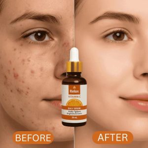 Relax Vitamin C Daily Serum  Brightening & Anti-Aging Face Serum - 30ml