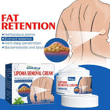 50G Lipoma Removal Cream Herbal Treatment For Safe And Effective Lipoma Reduction