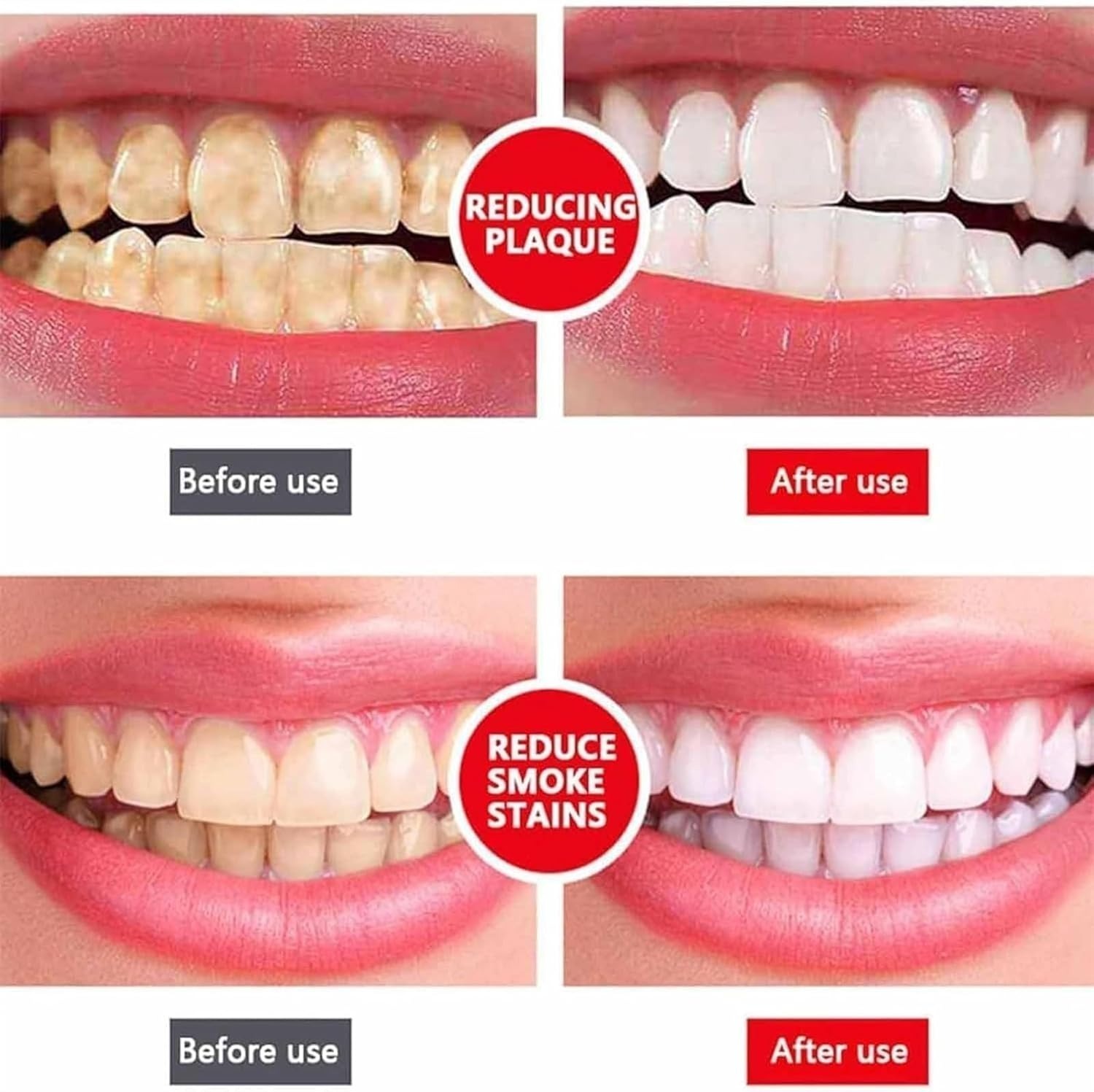 Yayashi Sp-4 Ultra Whitening Toothpaste Probiotic Stain Remover Stain Removing Toothpaste, Protects Gums Freshens Breath, for Everyone - Image 3