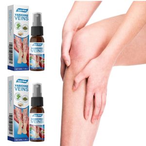 Varicose Veins Treatment Spray  Advanced Formula for Spider Veins, Leg Pain & Swelling Relief ~ 30ml