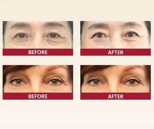 K-SECRET SEOUL 1988 Eye Cream: Retinal Liposome 2% + Fermented Black Bean Advanced Anti-Aging & Brightening Formula - 30ml - Image 3