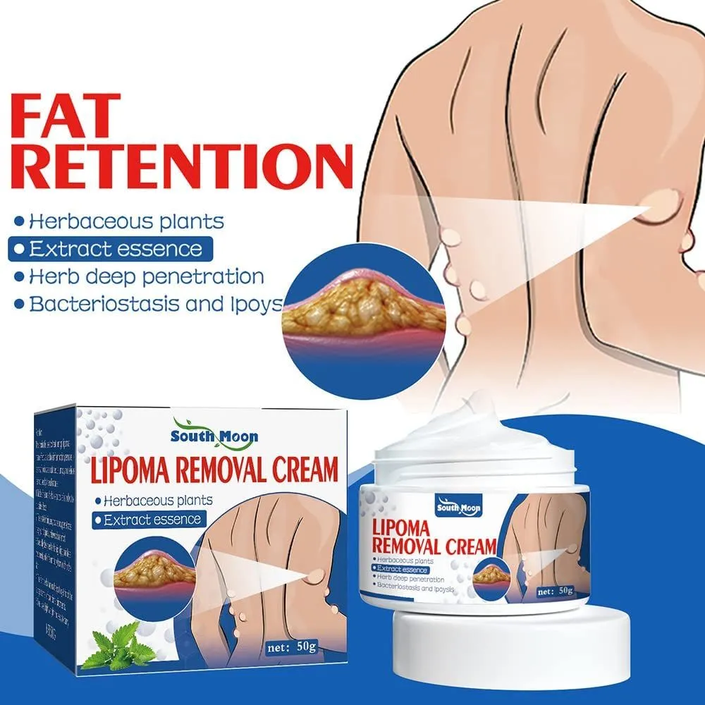 South Moon Lipoma Removal Cream Herbal Extract Essence Skin Care Treatment (50g) - Image 2