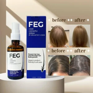FEG PLUS Hair & Beard Regrowth Spray Anti Hair Loss Formula with Minoxidil, Redensyl & Natural Extracts (50ml)