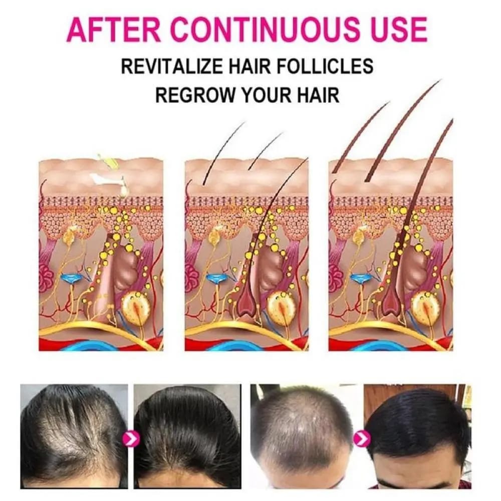 Anti-Grey Hair Serum, 30Ml - Image 2
