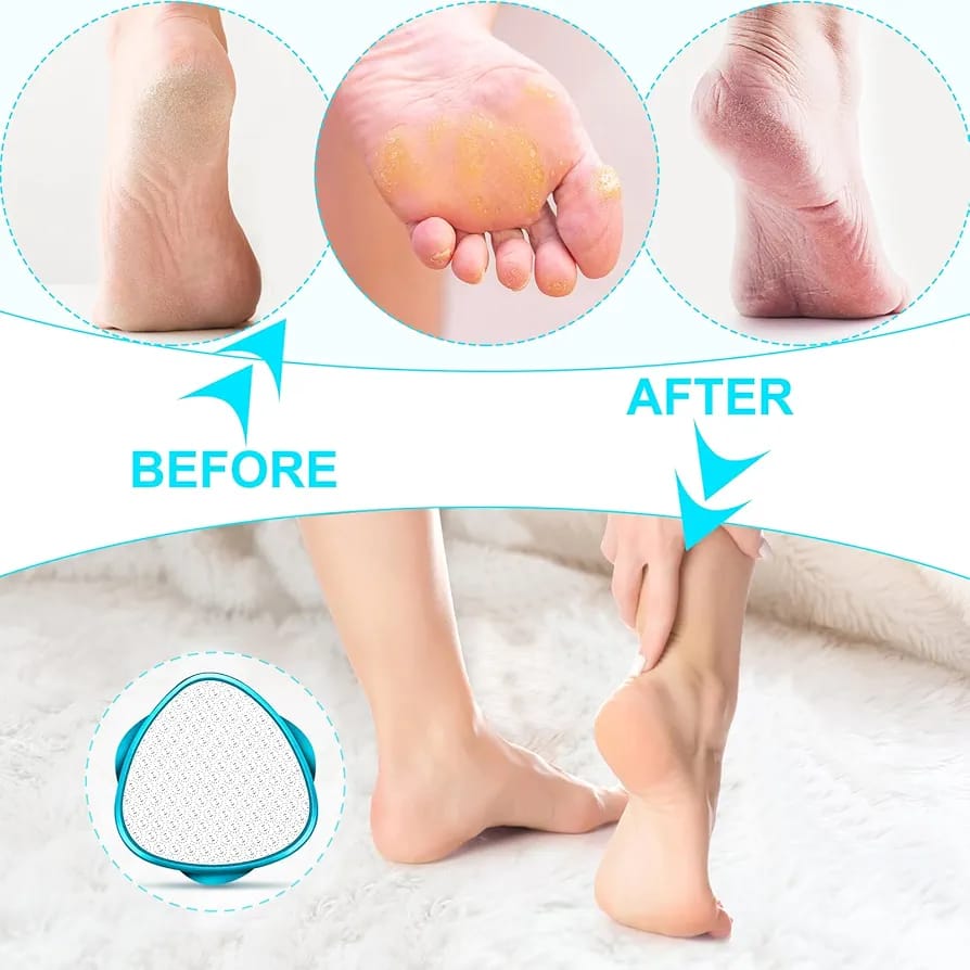 2 in 1 Double-Sided Nano Glass Callus Remover & Crystal Hair Eraser Safe & Quick Foot File, Dead Skin & Hard Callus Remover, Painless Epilator for Women, Portable Pedicure Tool (Random Color) - Image 2