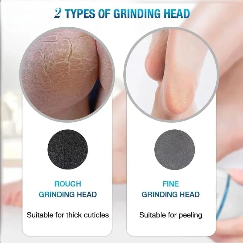 Back Callus Remover with Built-In Vacuum Electric Foot Grinder for Dead Skin, Cracked Heels & Calluses, Rechargeable Pedicure Tool with Gentle & Powerful Exfoliation - Image 3