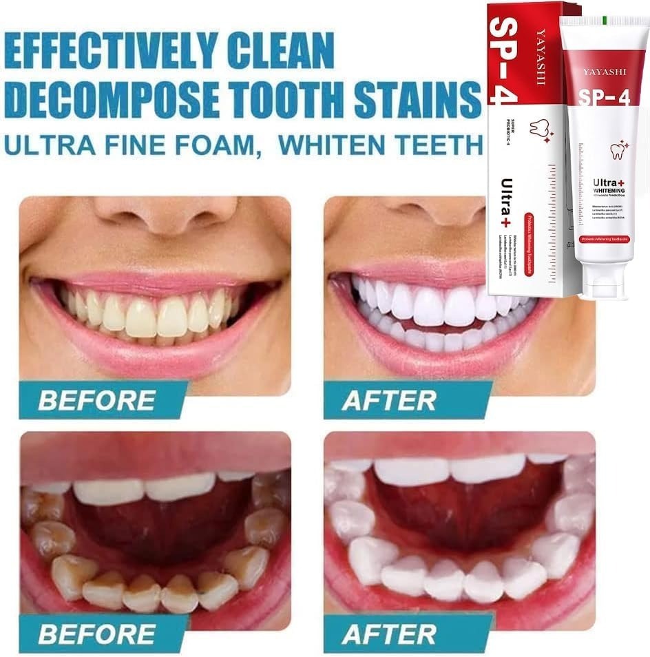 Yayashi SP-4 Ultra Whitening Toothpaste 150ml Probiotic Stain Remover for Bright, Healthy Teeth - Image 4