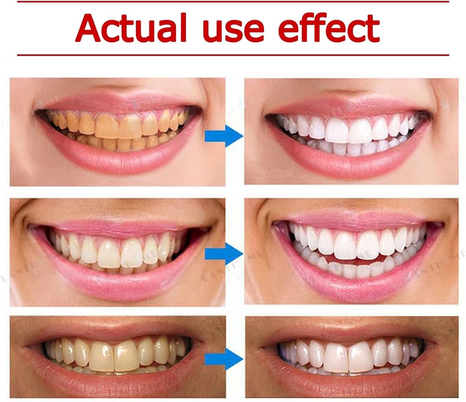 Yayashi SP-4 Ultra Whitening Toothpaste 150ml Probiotic Stain Remover for Bright, Healthy Teeth - Image 3