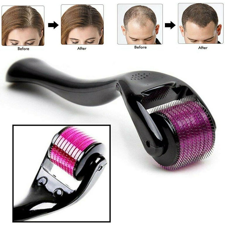 Derma Roller 0.5mm Micro Needle for Skin Care, Hair Growth, Acne Scars & Anti-Aging - Image 4