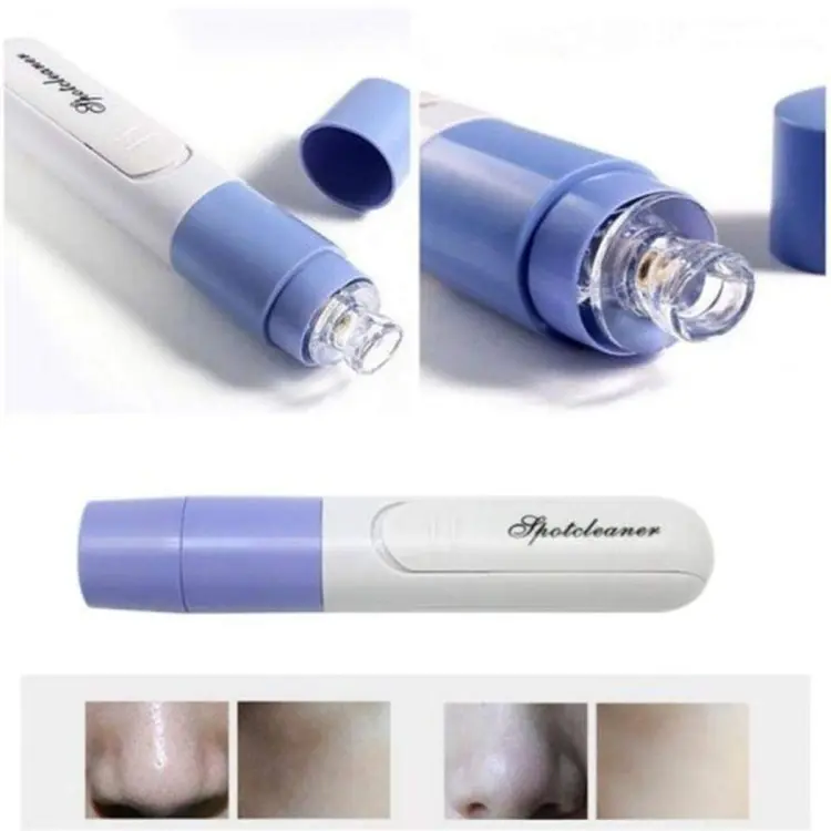 New Electric Blackhead Remover Sucker Black Head Pimple Pore Cleaner Vacuum Blackhead Remover Pore Cleaner (Random color) - Image 2