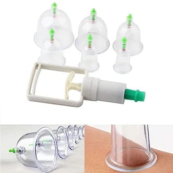 10-Piece Hijama Cupping Therapy Set Vacuum Suction Massage Cups with Pull-Out Pump - Image 3