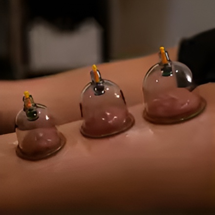 10-Piece Hijama Cupping Therapy Set Vacuum Suction Massage Cups with Pull-Out Pump - Image 4