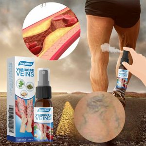 South Moon Varicose Veins Treatment Spray – 30ml Advanced Formula for Spider Veins, Leg Pain & Swelling Relief | Natural Herbal Spray for Better Circulation