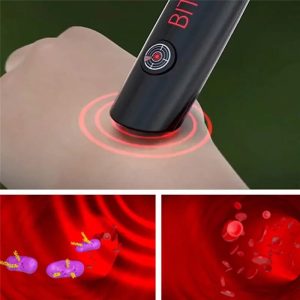 Mosquito Antipruritic Device – Instant Bite Relief Pen | Reduces Itching & Swelling for Adults & Children | Outdoor Camping Summer Essential