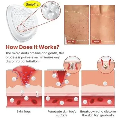 DermaSmooth Skin Tag Remover Patch 40 Pcs – Adhesive Skin Tag Care Patches - Image 3