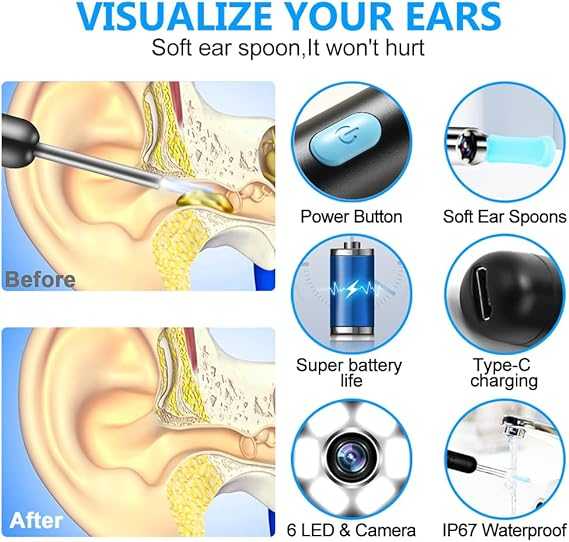 Smart Visual Ear Cleaner โ HD Camera Ear Wax Removal Tool with LED Light - Image 4
