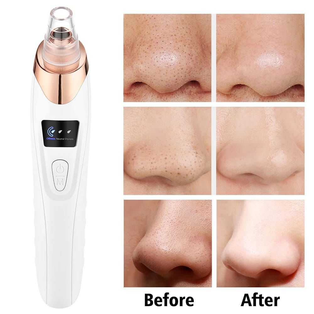 Electric Blackhead Remover Vacuum โ Professional Pore Cleaner with Acne Needle & Skin Care Kit - Image 2