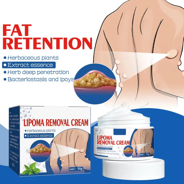 Lipoma Removal Cream In Pakistan